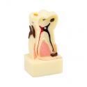 A tooth