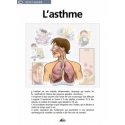 Asthma
